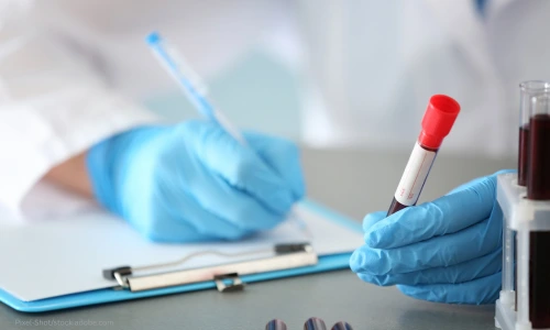 Ein Arzt mit Handschuhen ud weißem Kittel untersucht eine Blutprobe